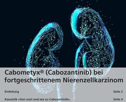 Cabometyx® (Cabozantinib) bei fortgeschrittenem Nierenzellkarzinom